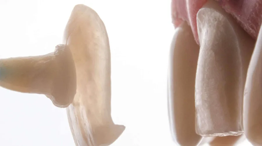 Estética Dentária